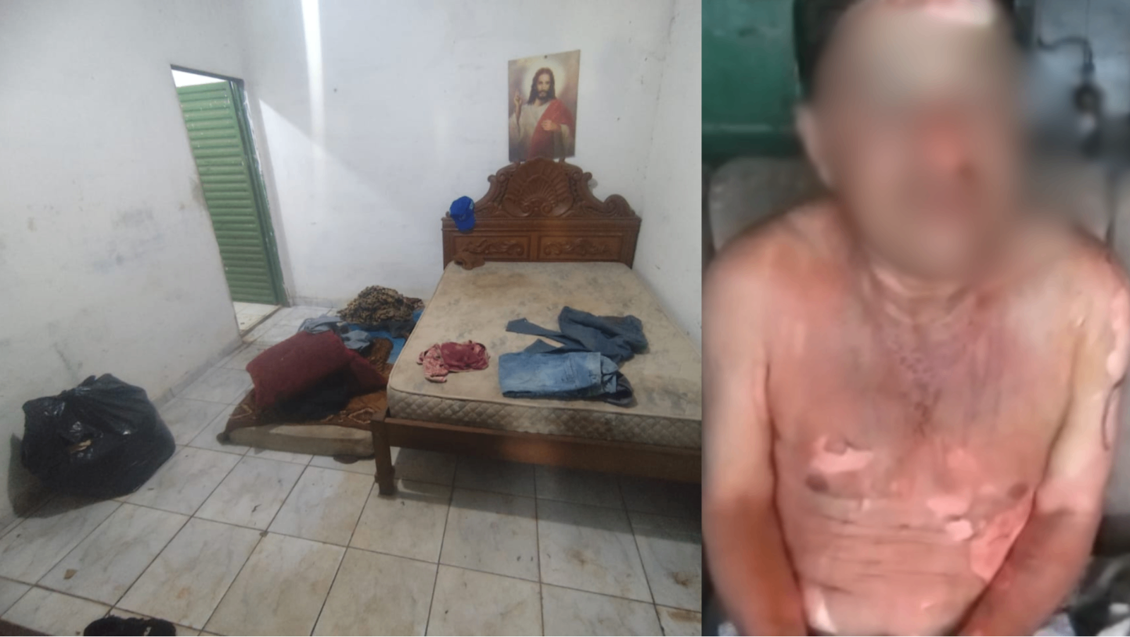 Homem é queimado e esfaqueado em Monte Carmelo; mulher foi presa